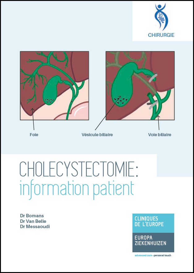 Cholecystectomie